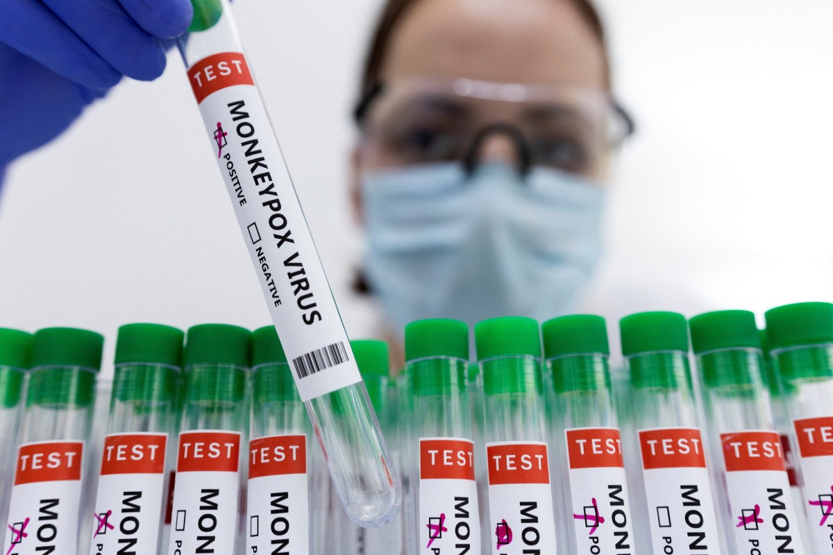 Don’t worry; you don’t need to start freaking out about monkeypox on top of coronavirus. Photo: Reuters