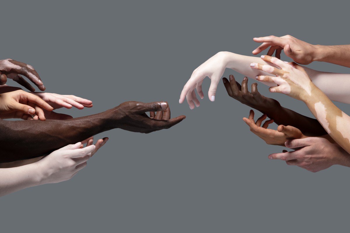 Skin conditions will not always look the same on different skin tones. Photo: Shutterstock