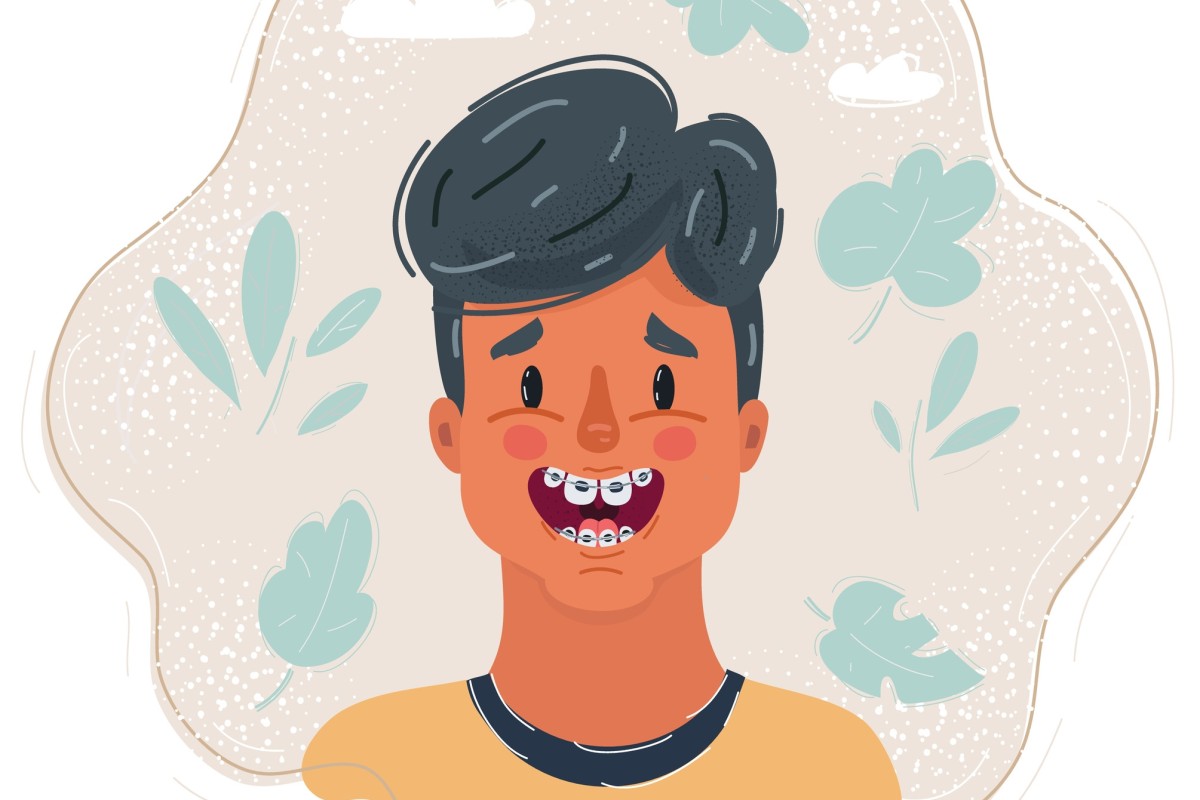 Asking for a Friend Help! I just got braces, and now I am too nervous