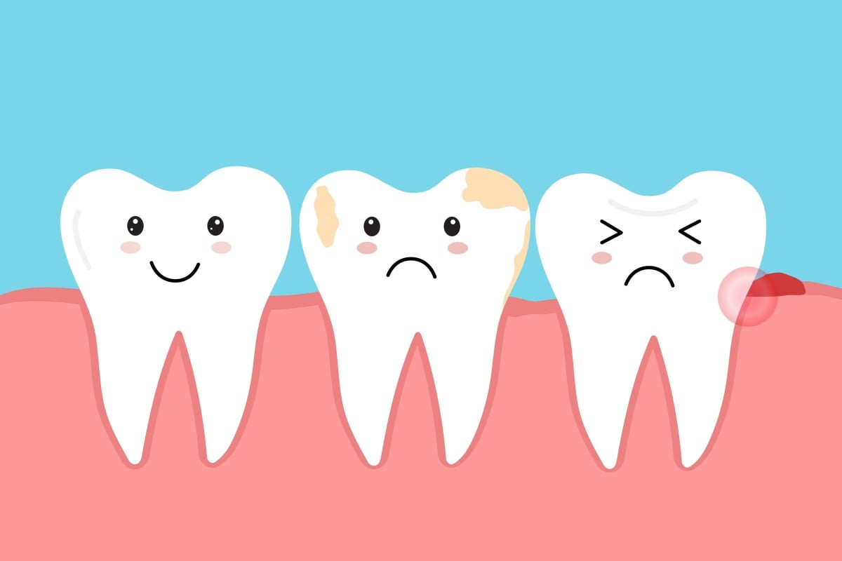 Young Post readers invent brilliant toothbrush ideas to fight tooth decay and gum disease. Photo: Shutterstock