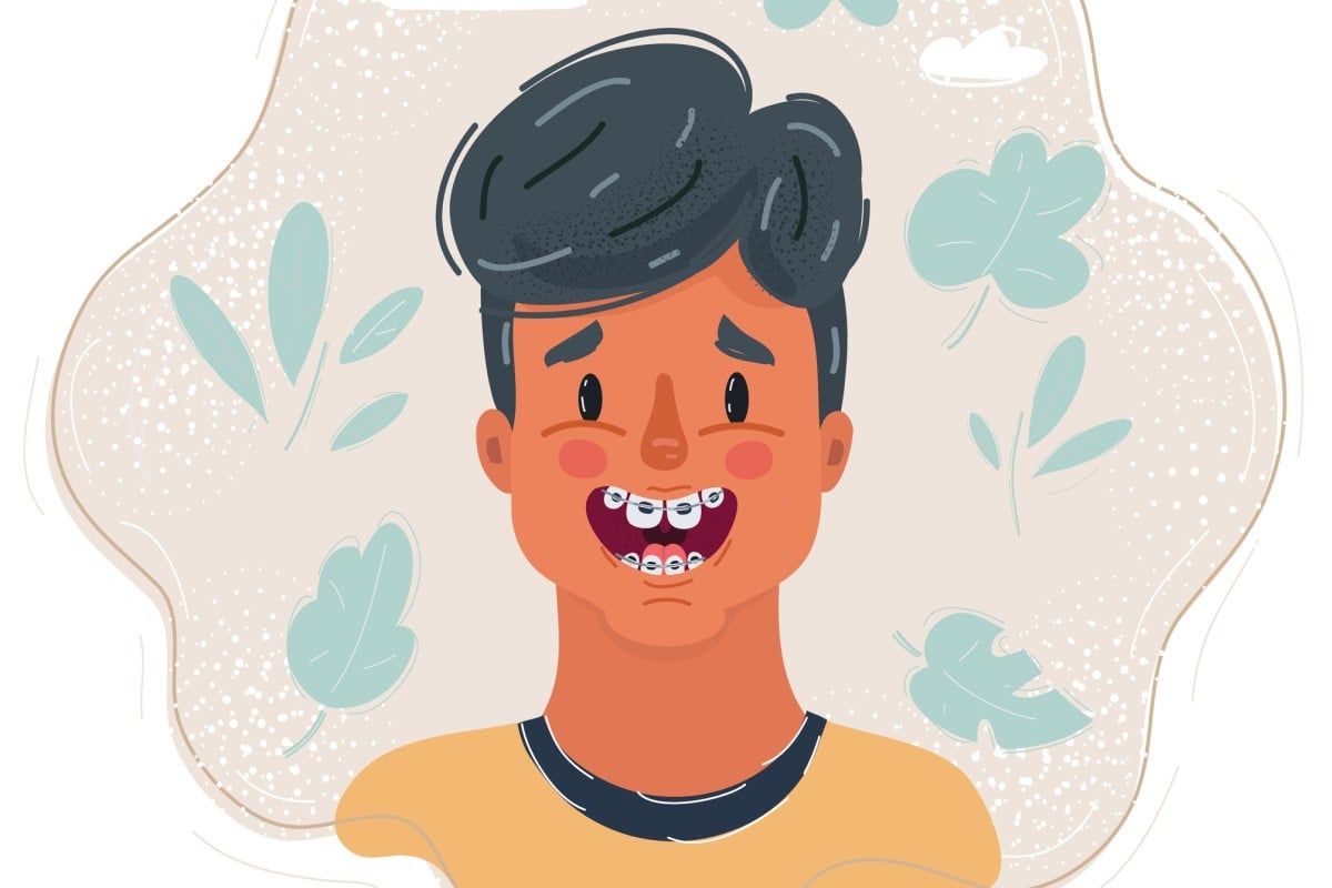 From the fear of dental tools to the anxiety of the bill, Hong Kong students share their biggest dental phobias and how they cope. Photo: Shutterstock