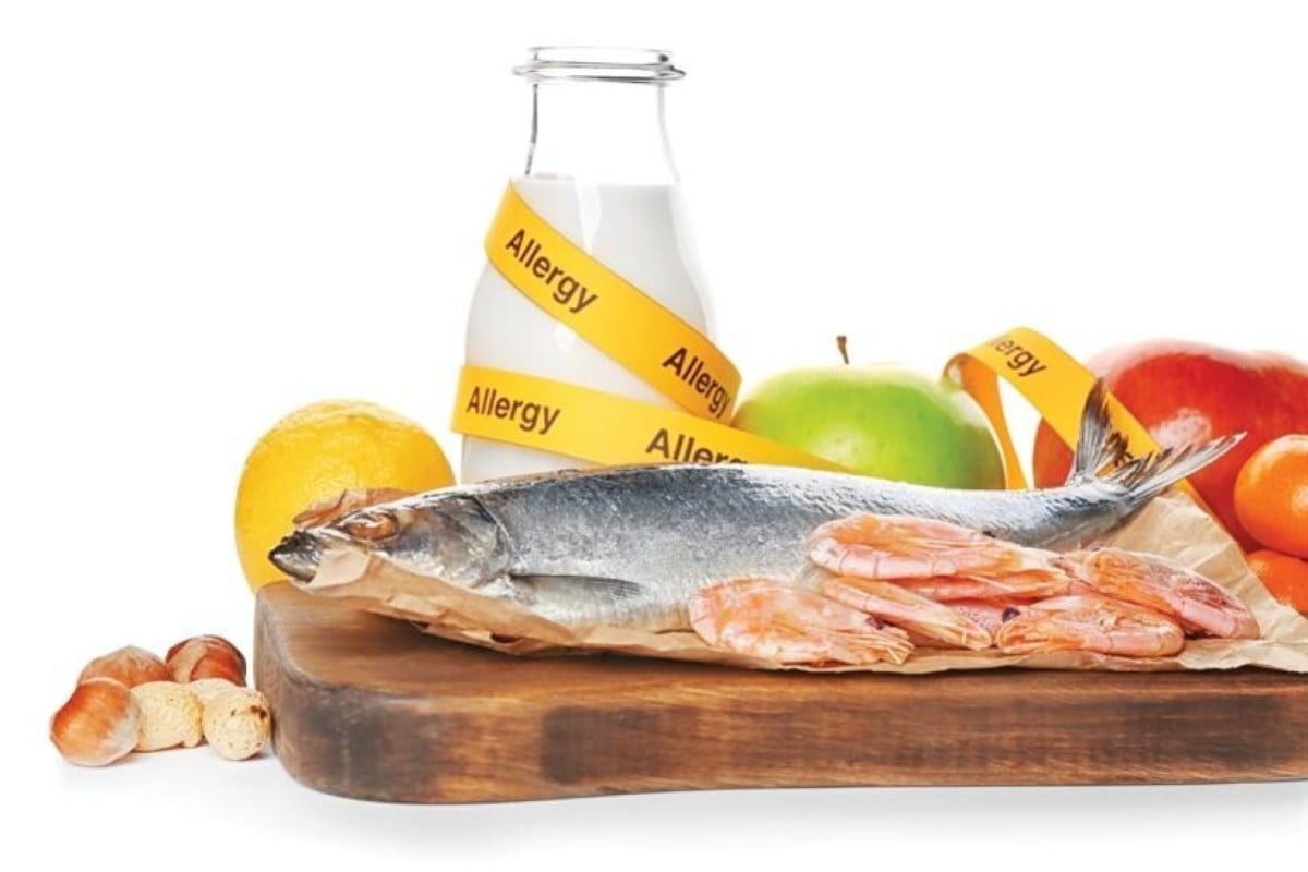 For people with food allergies, knowing what they can eat can often be a pain.