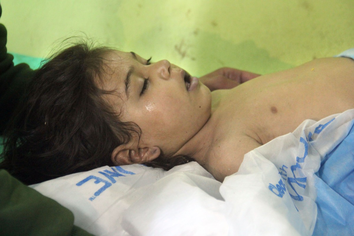 An unconscious Syrian child receives treatment at a hospital in Khan Sheikhun, a rebel-held town in the northwestern Syrian Idlib province, following a suspected toxic gas attack on April 4, 2017.
