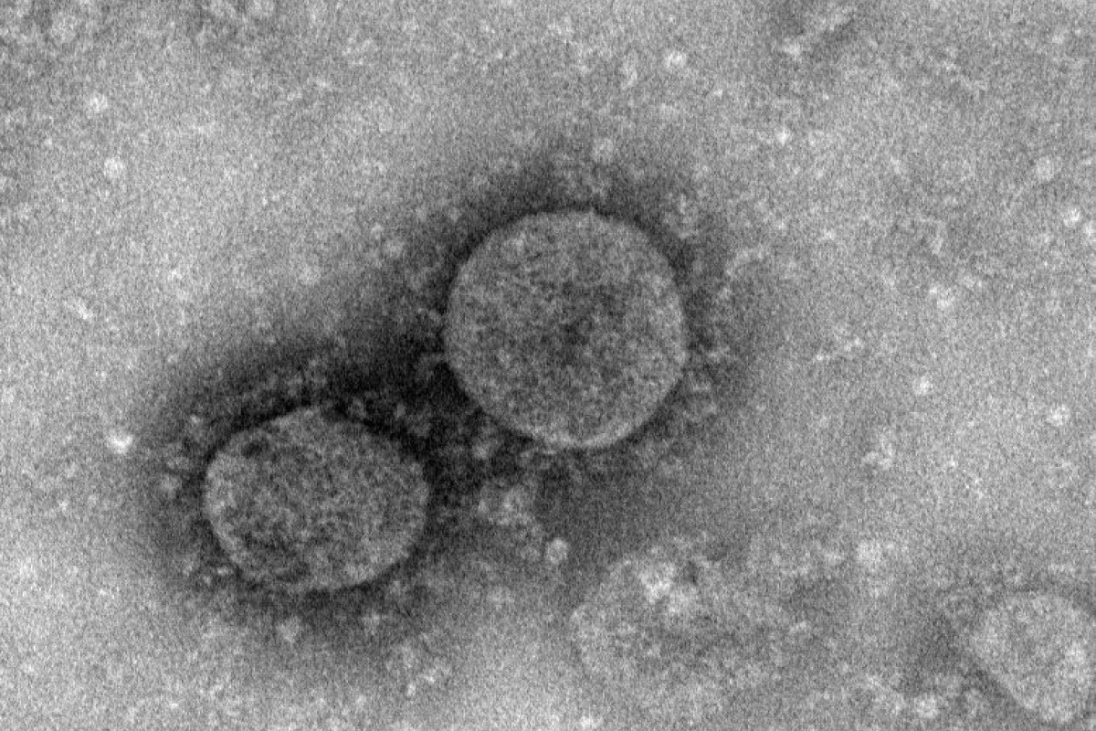 The previously unknown coronavirus has killed more than 100 people and infected thousands. Photo: National Microbiology Data Centre
