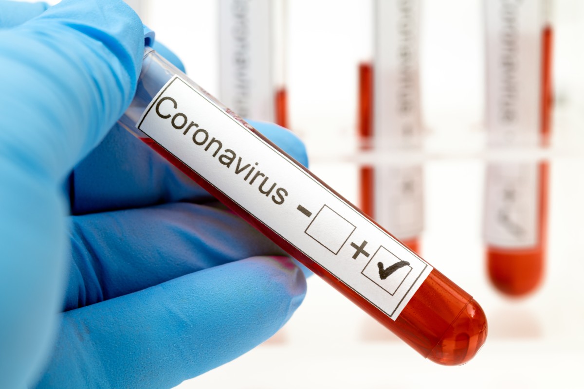 What's it like to test positive for Covid-19?