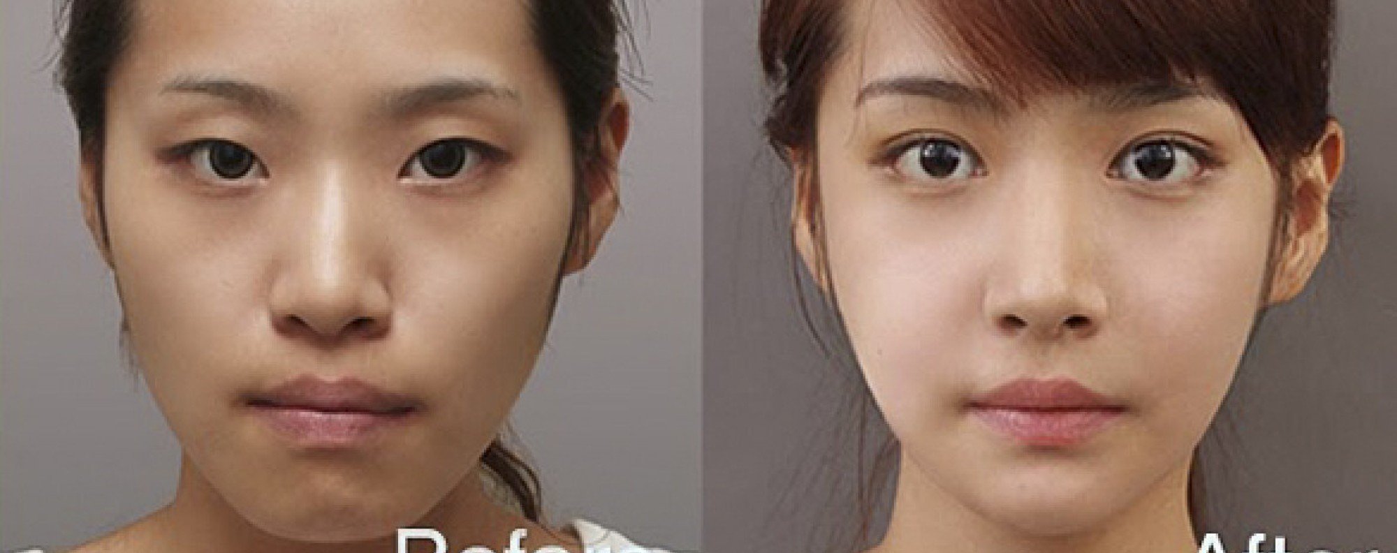 Chinese eye operation clearance