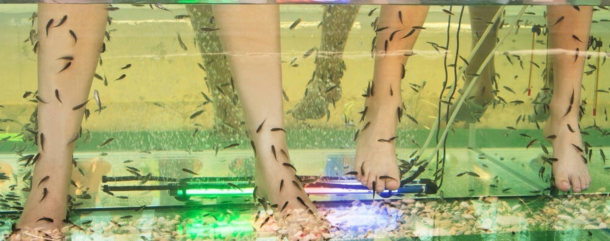 Are Your Feet Turning White And Soft With Little Holes In The Skin When You Run Or Sweat You Might Have Pitted Keratolysis South China Morning Post Are Your Feet Turning White And Soft With Little Holes In The Skin When You Run Or Sweat You Might Have Pitted Keratolysis South China Morning Post