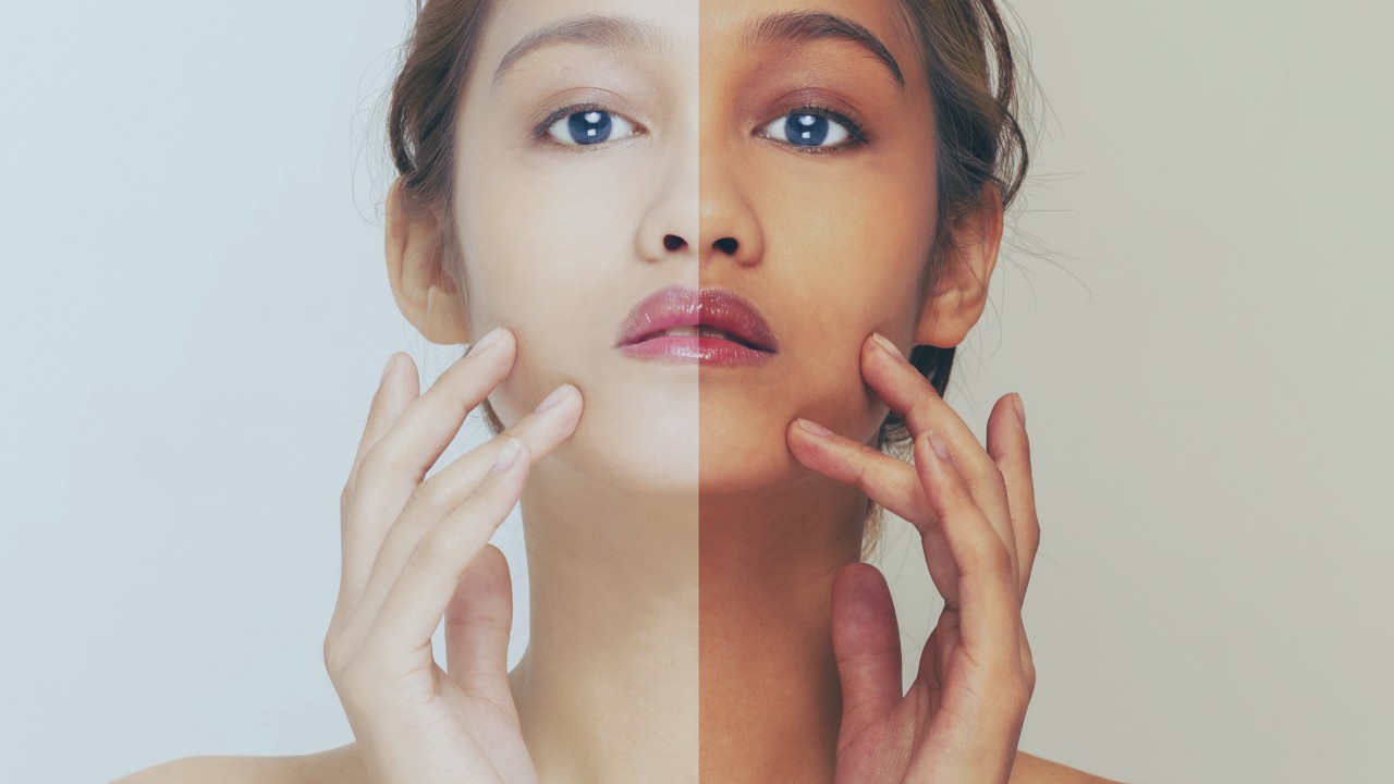 Asia Is Obsessed With Skin Whitening But The Backlash Is