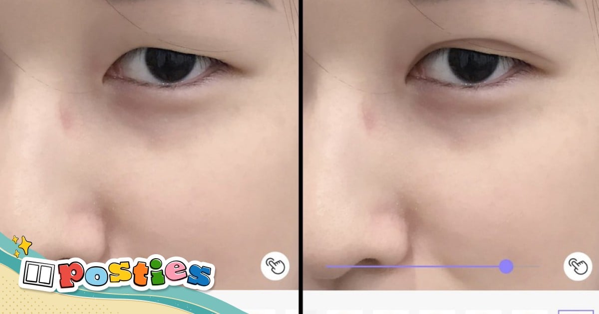 Baby online double eyelid