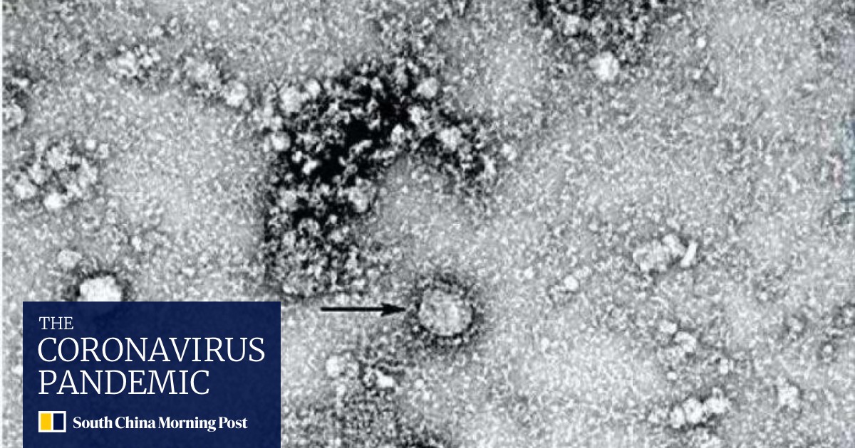 Scientists Debate Whether Wuhan Coronavirus Came From Bats Or Snakes Amid Joint Us China Effort To Develop Vaccine South China Morning Post