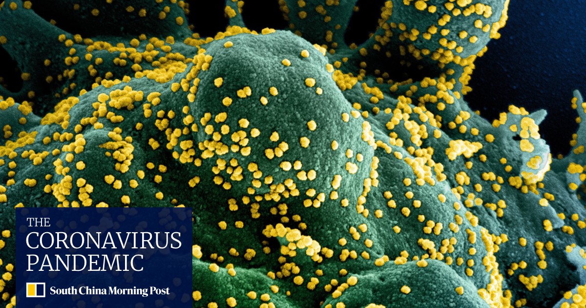 Blood thinners may help sickest Covid19 patients survive, US study