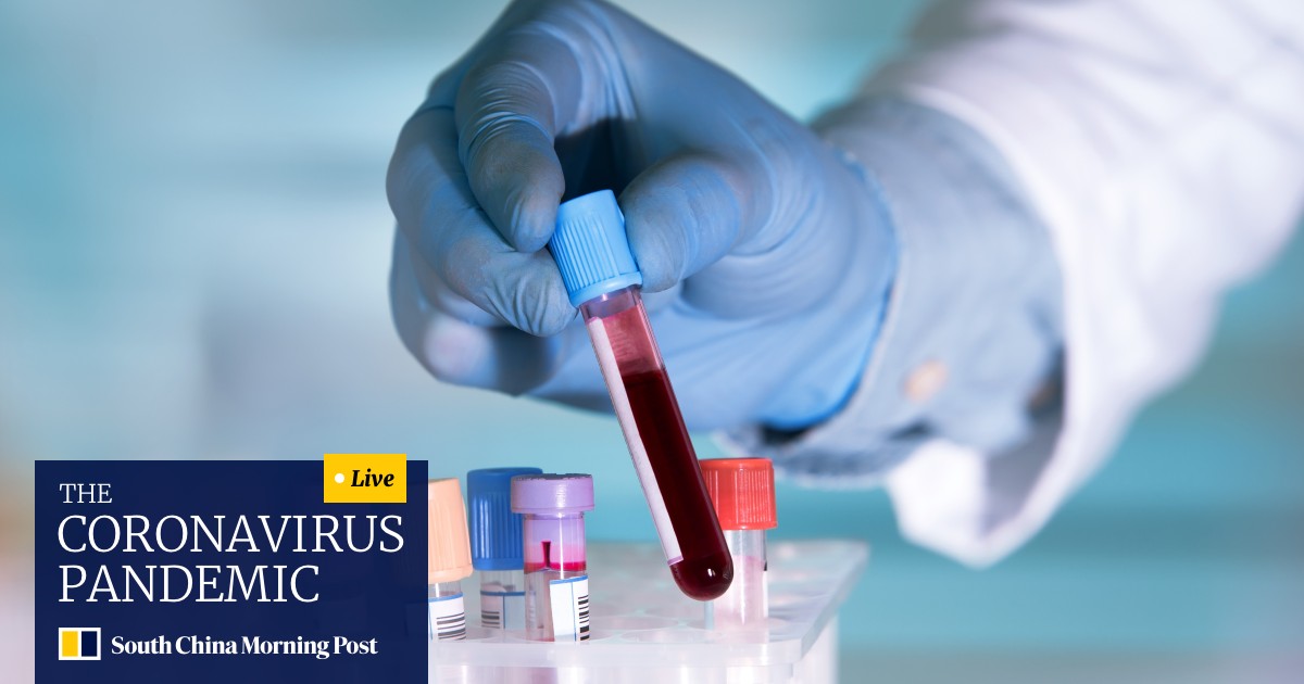 People With Blood Type A May Be More Vulnerable To Coronavirus China Study Finds South China Morning Post