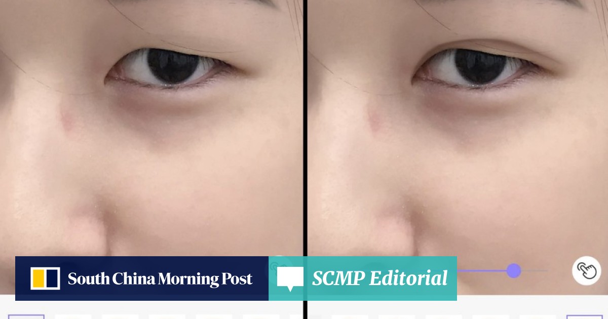 Double eyelid deals surgery hong kong