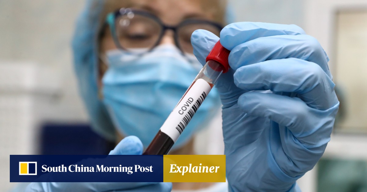 Covid19 antibody test what does your result mean? Why a high score is