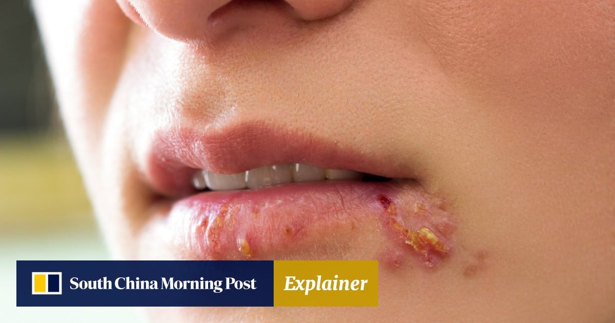 https://cdn.i-scmp.com/sites/default/files/styles/og_image_scmp_explainer/public/d8/images/canvas/2025/05/13/968bcba8-23ab-469c-9bd4-aae9c08f73c3_6cf81181.jpg?itok=7vHi0zD4&v=1747110841