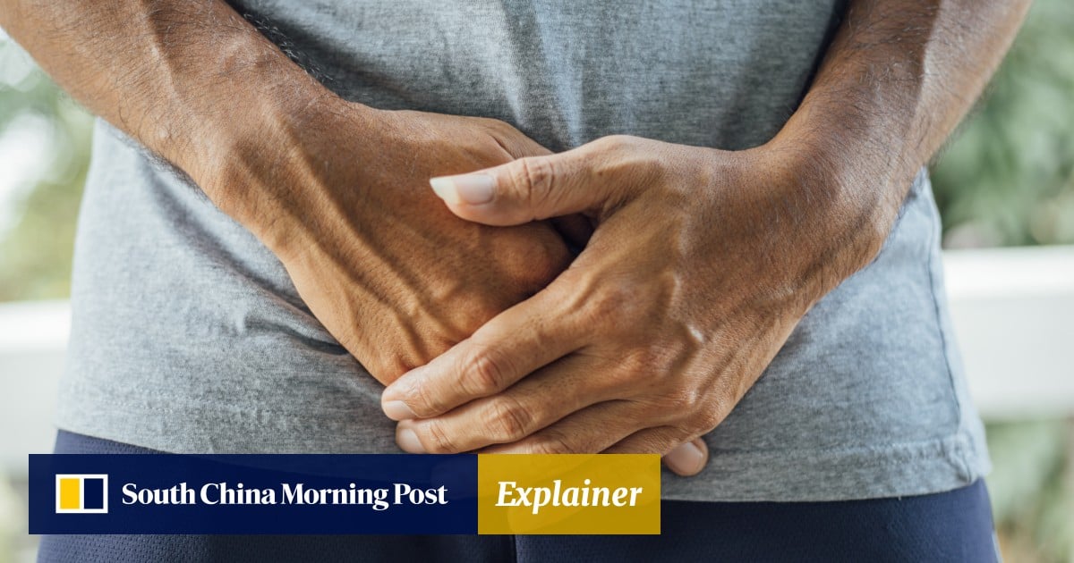 Explainer | How common is prostate cancer in Hong Kong and what can you do to treat it?