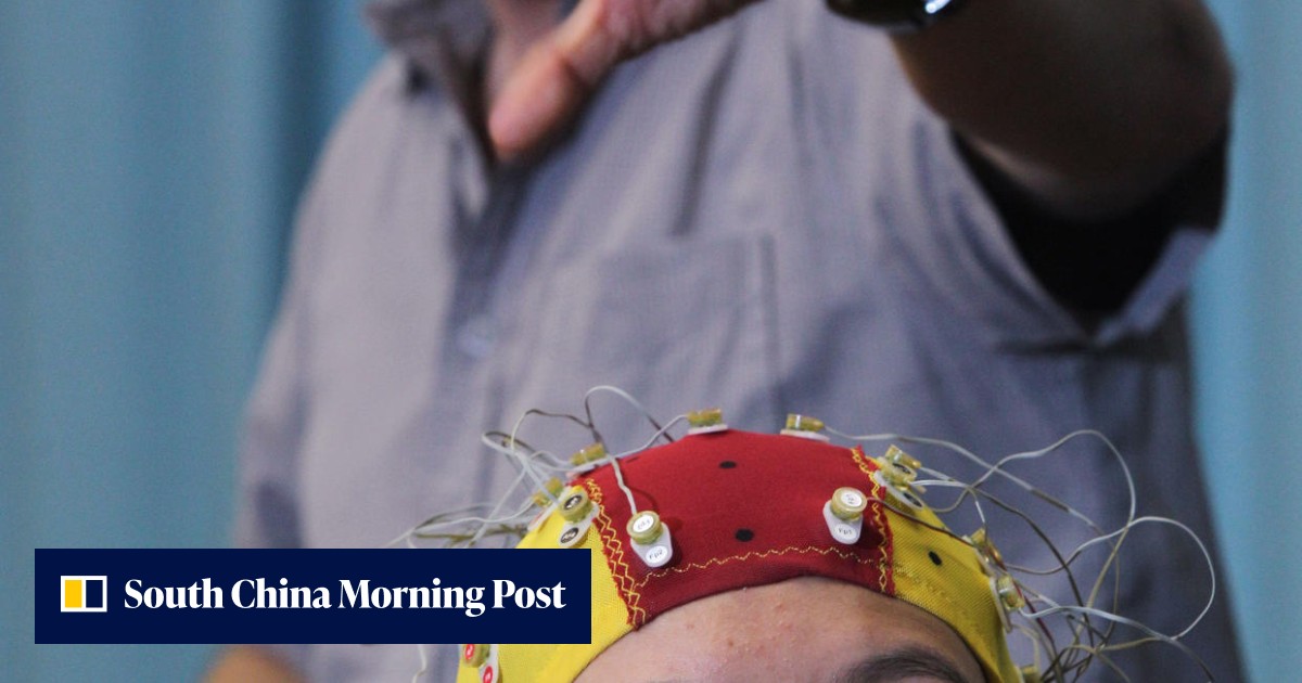 Cyborg Injection Contraptions and implants for the wannabe cyborg | South China Morning Post