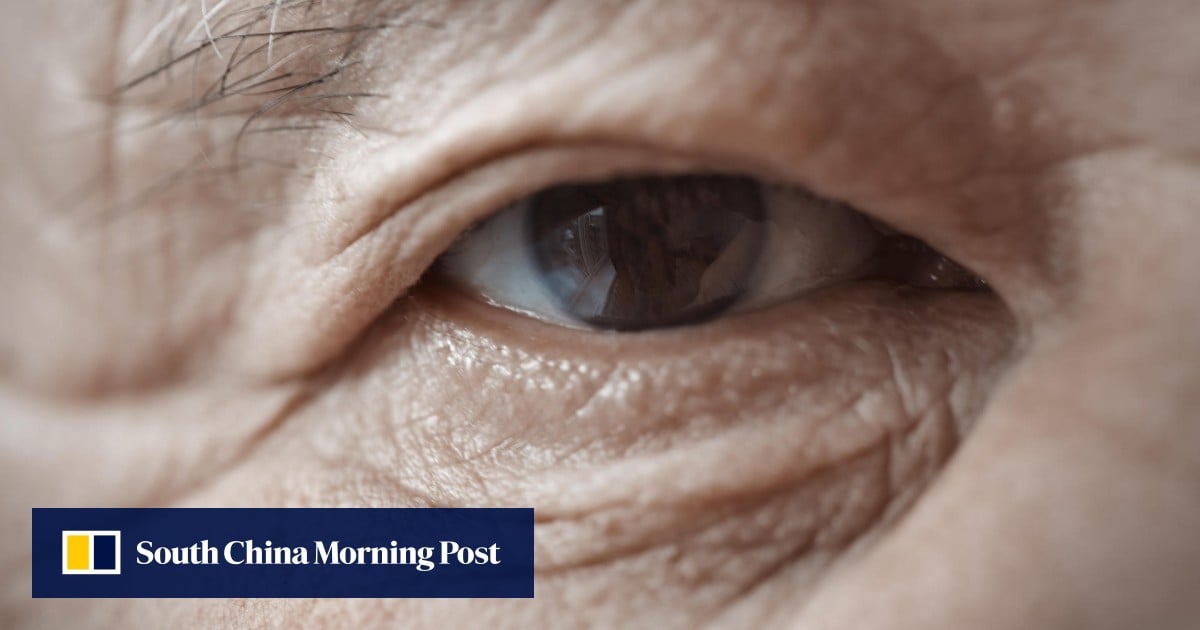 How you can avoid losing vision by macular degeneration as you get