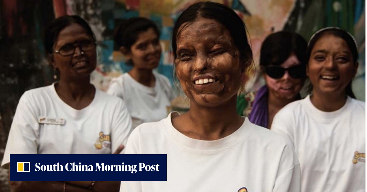 India’s acid attack survivors fight for change | South China Morning Post