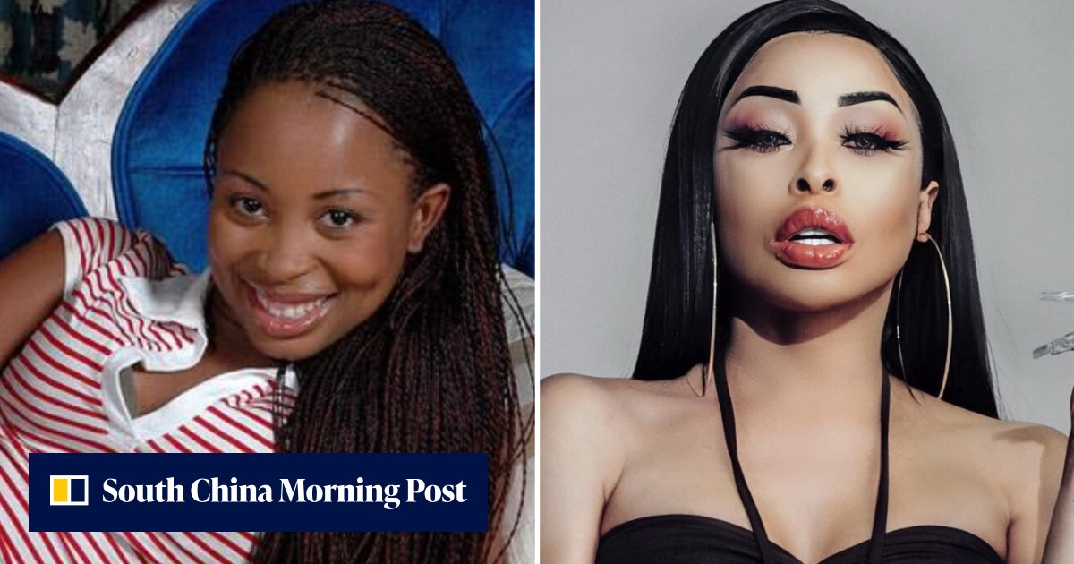 Khanyi Mbau's dramatic body transformation: Netflix's Young, Famous and African star believes it's her duty to 'look like a doll' and even invited media to watch her liposuction