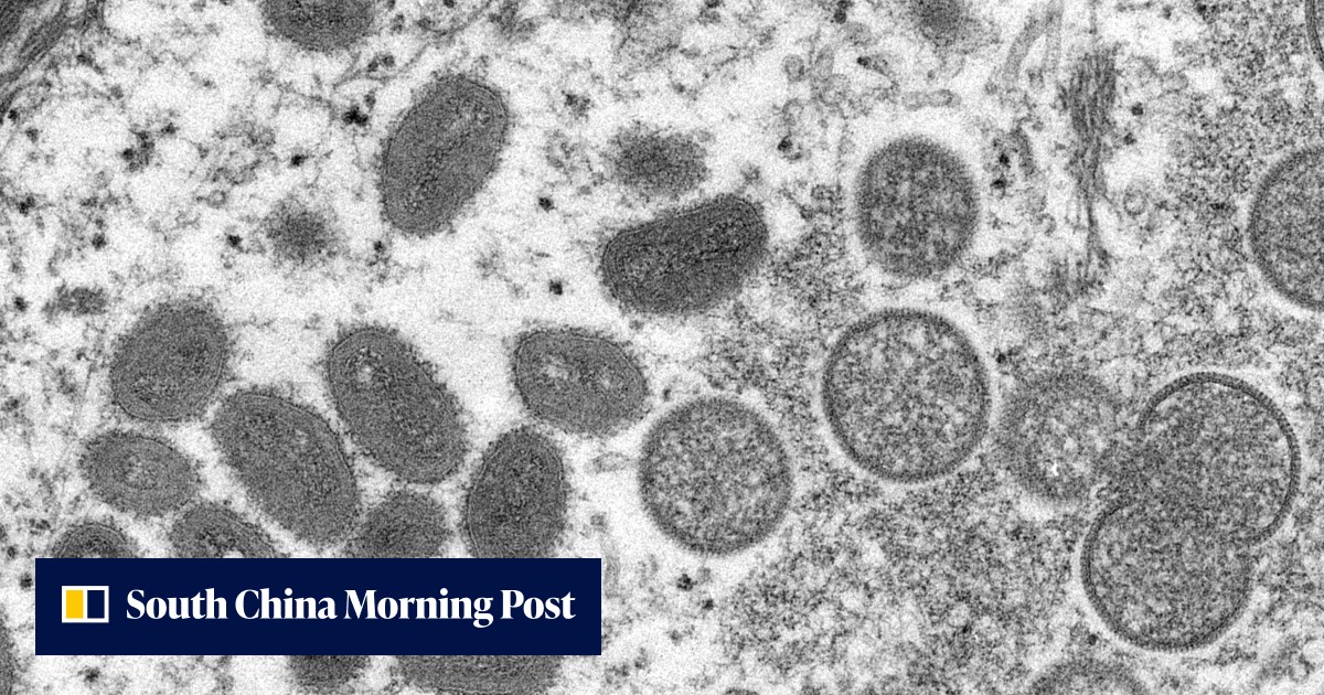 Monkeypox Recent Rare monkeypox outbreaks detected in North America and Europe | South ...