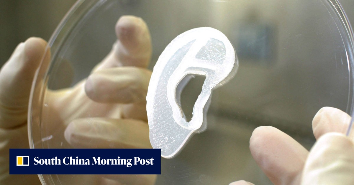 US surgeons transplant 3D ear made of living cells | South China ...