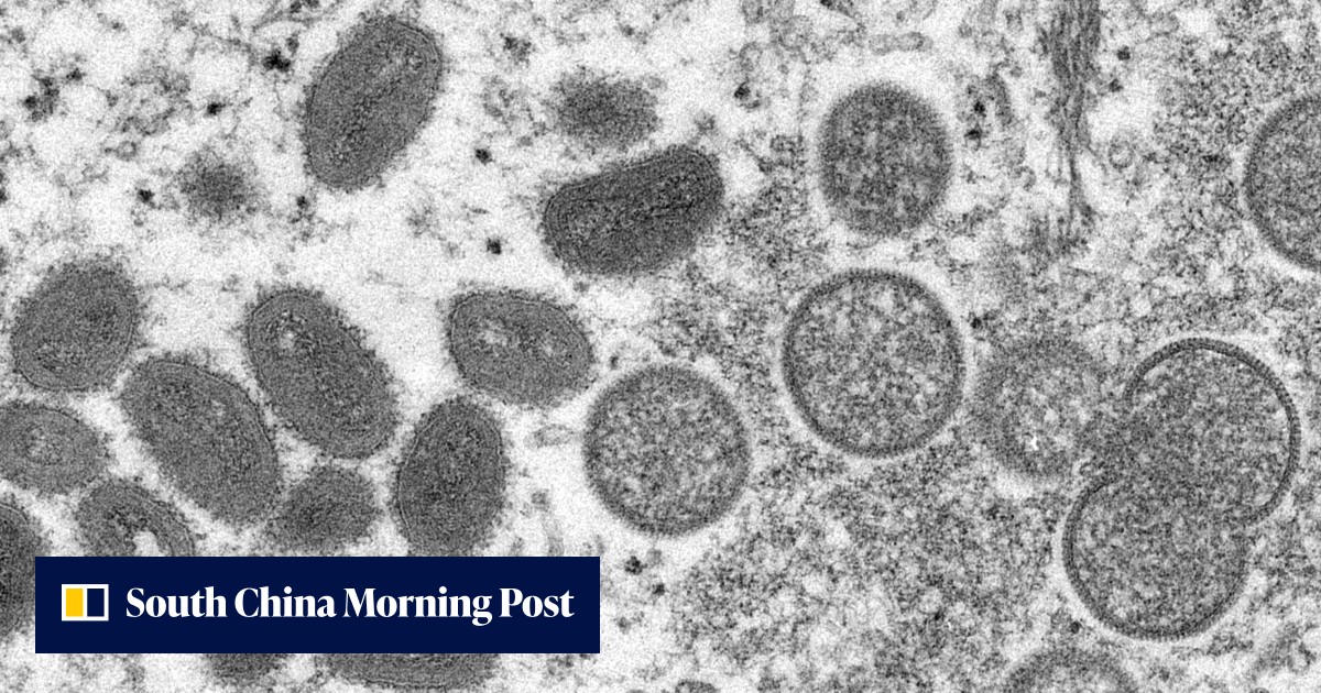 China calls for overseas arrivals to be monitored for signs of ...