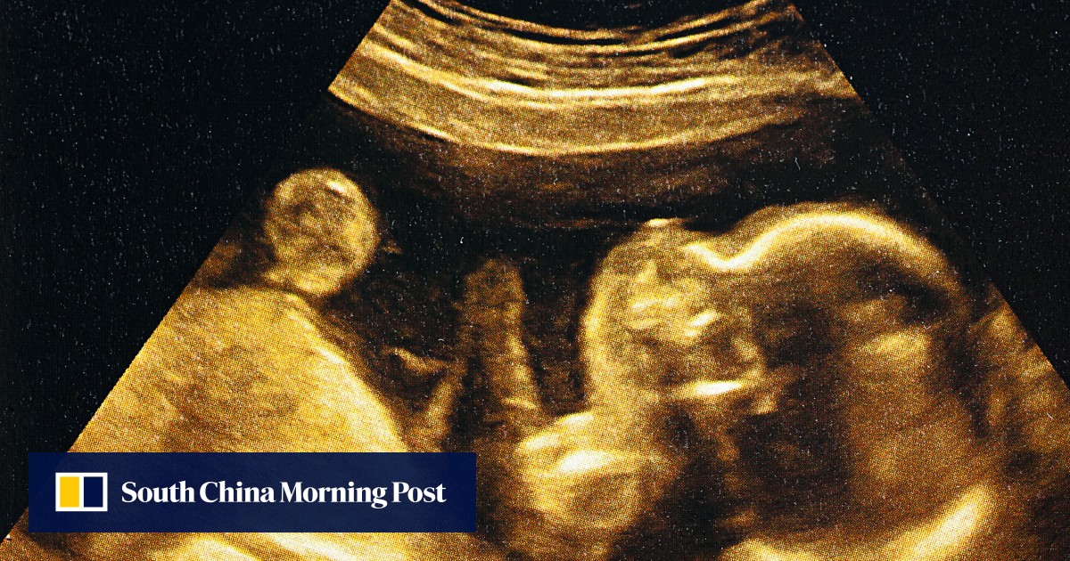 Testing embryos on major disease risk? It’s for ‘a better roll of the dice’
