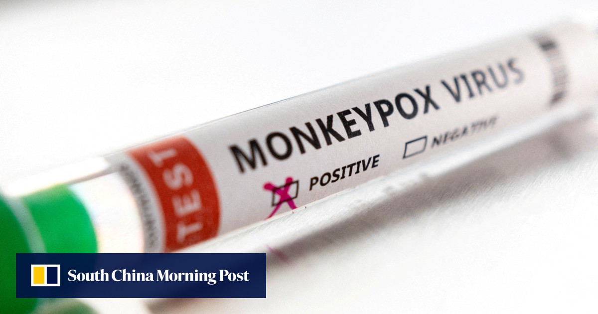 Singapore confirms first local monkeypox case