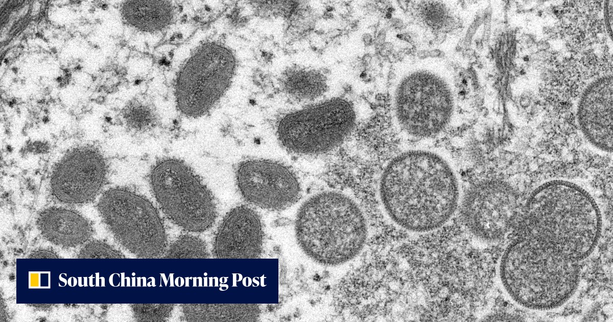 Hong Kong activates monkeypox response plan as resident returning from ...