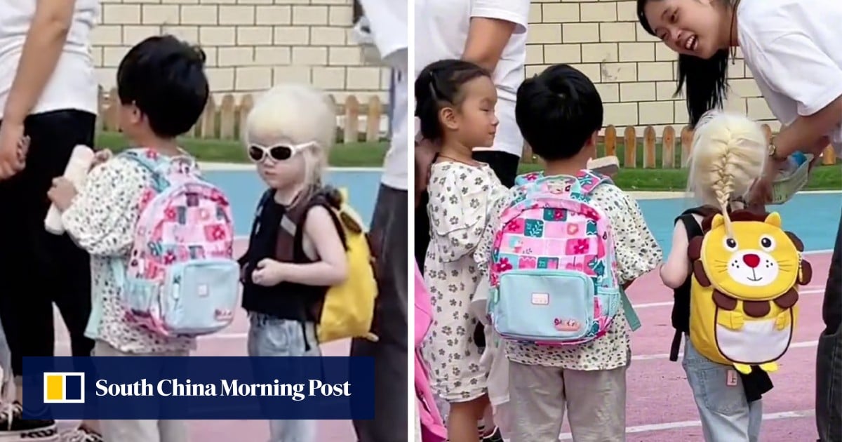 ‘Everyone likes her’: Chinese albino girl’s warm welcome on first day ...