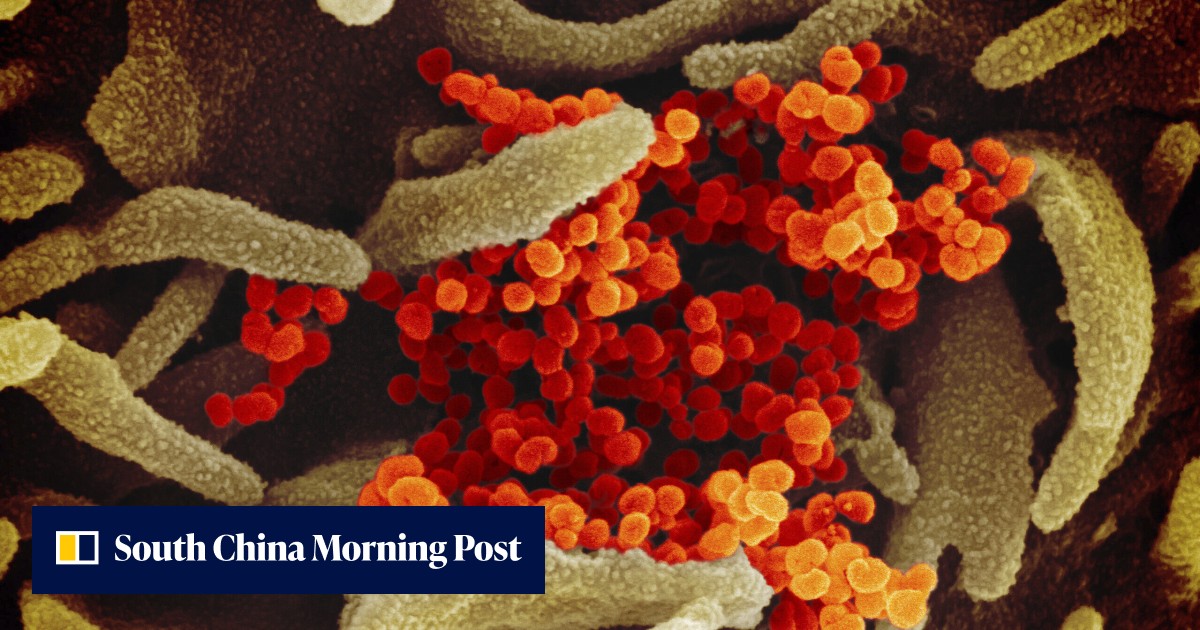 Getting Covid-19 more than once raises risk of heart, lung and other ...