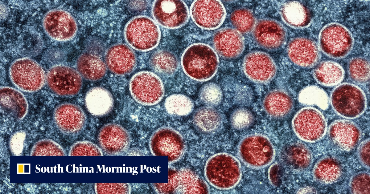 WHO renames monkeypox as mpox, citing racism concerns | South China ...