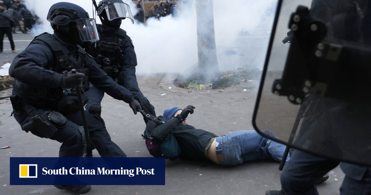 Man loses testicle after clubbing by police during Paris pension protests, plans to sue Man loses testicle after clubbing by police during Paris pension protests, plans to sue