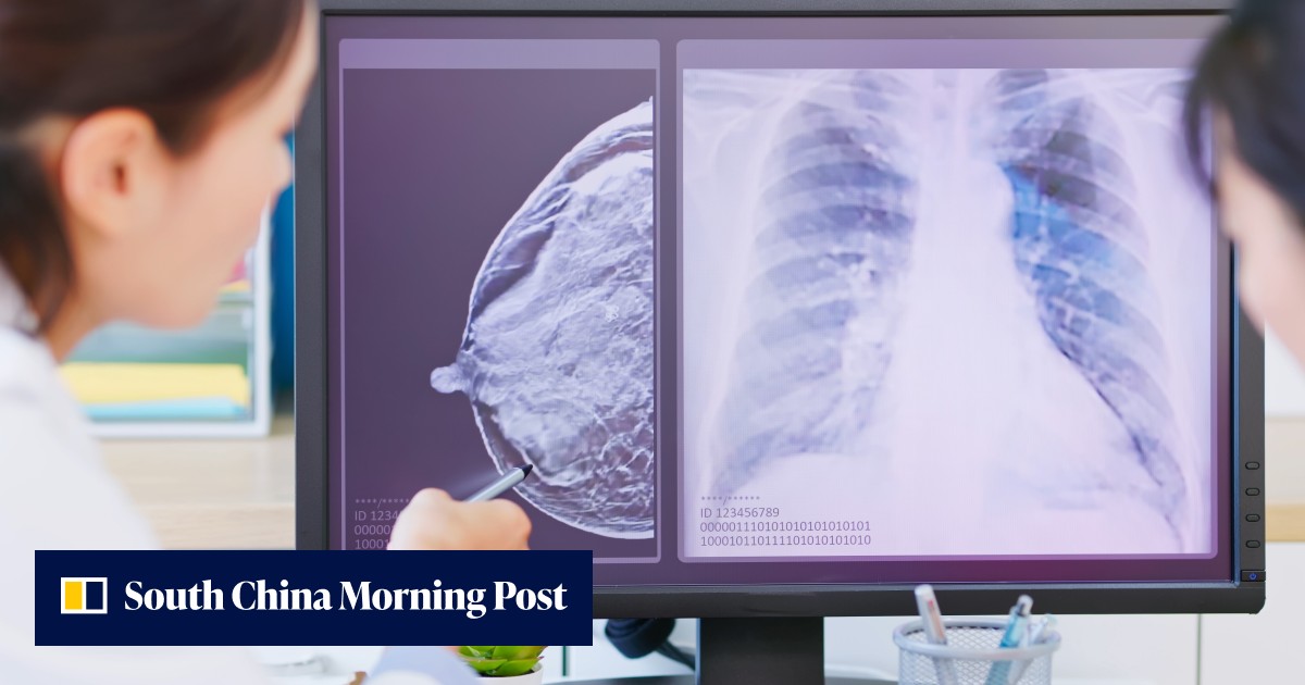 The future of cancer treatment: better tests, new drugs and more ...