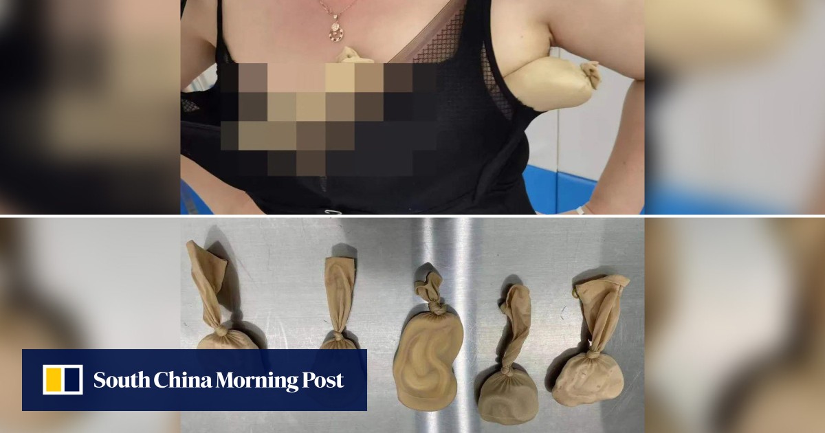 Customs officials noticed her 'weird' body shape. She had 5 live snakes in  bra