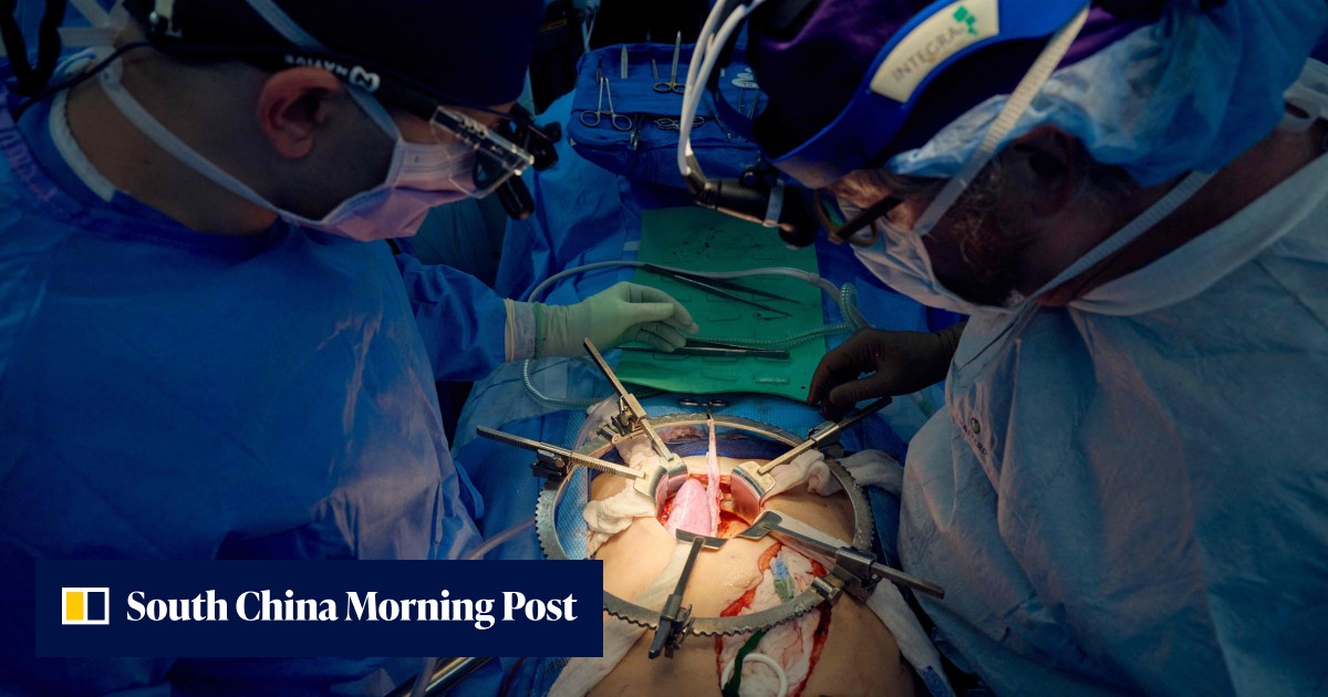 Pig kidney works in donated body for over a month in step toward ...