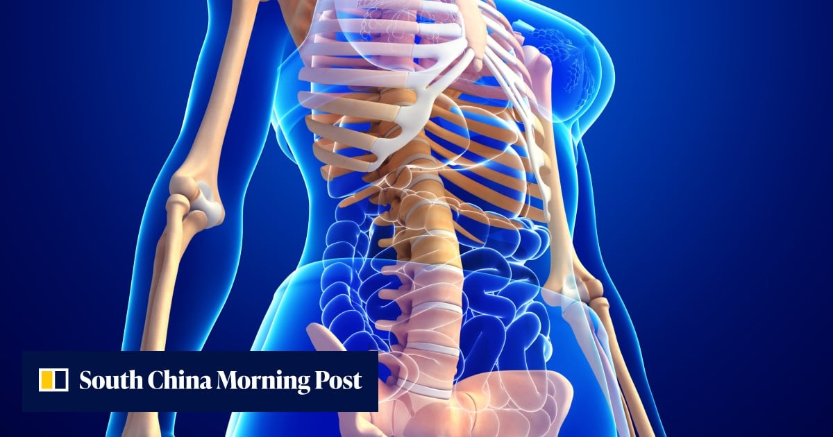 How to prevent osteoporosis – a loss of bone density – and why it is key ...