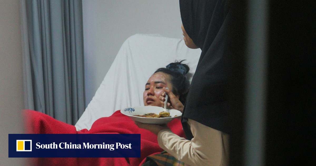 Korban Letusan Marabi di Indonesia Bersumpah Tidak Akan Mendaki Lagi: ‘Saya Tidak Mau’