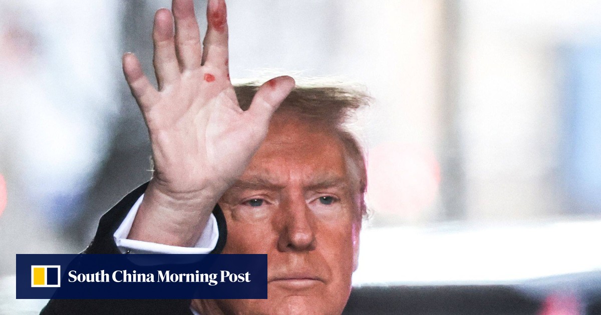 What are the mysterious red marks on Donald Trump’s hand?