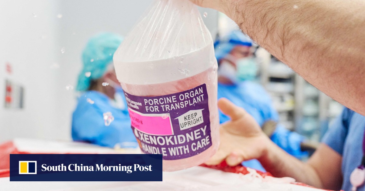 US man who was first to receive gene-edited pig kidney transplant dies 2 months later