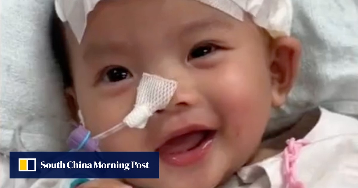 Hong Kong girl ‘Little Suetyee’ undergoes ‘successful’ 3hour surgery