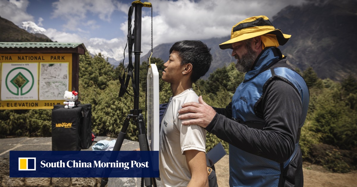 X-ray tests in Nepal powered by AI hailed as key in global TB eradication