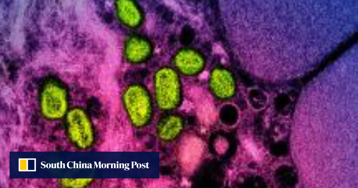 WHO confirms first case of new mpox outside of Africa as outbreak spreads