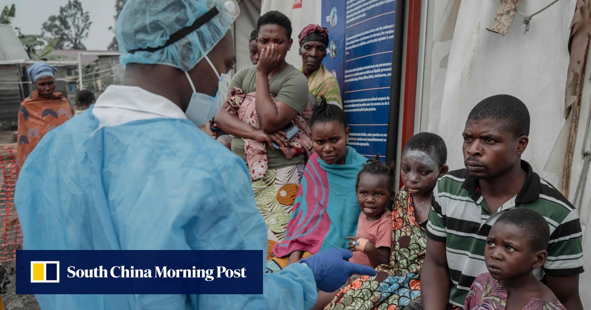 Mpox surge in DR Congo: hospital overwhelmed with patients as virus vaccine demand rises