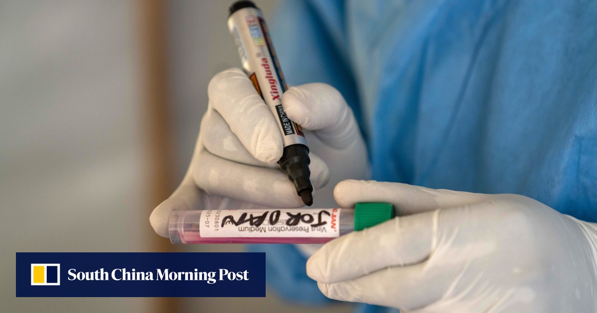 Mpox is not the new Covid-19, says WHO official Hans Kluge