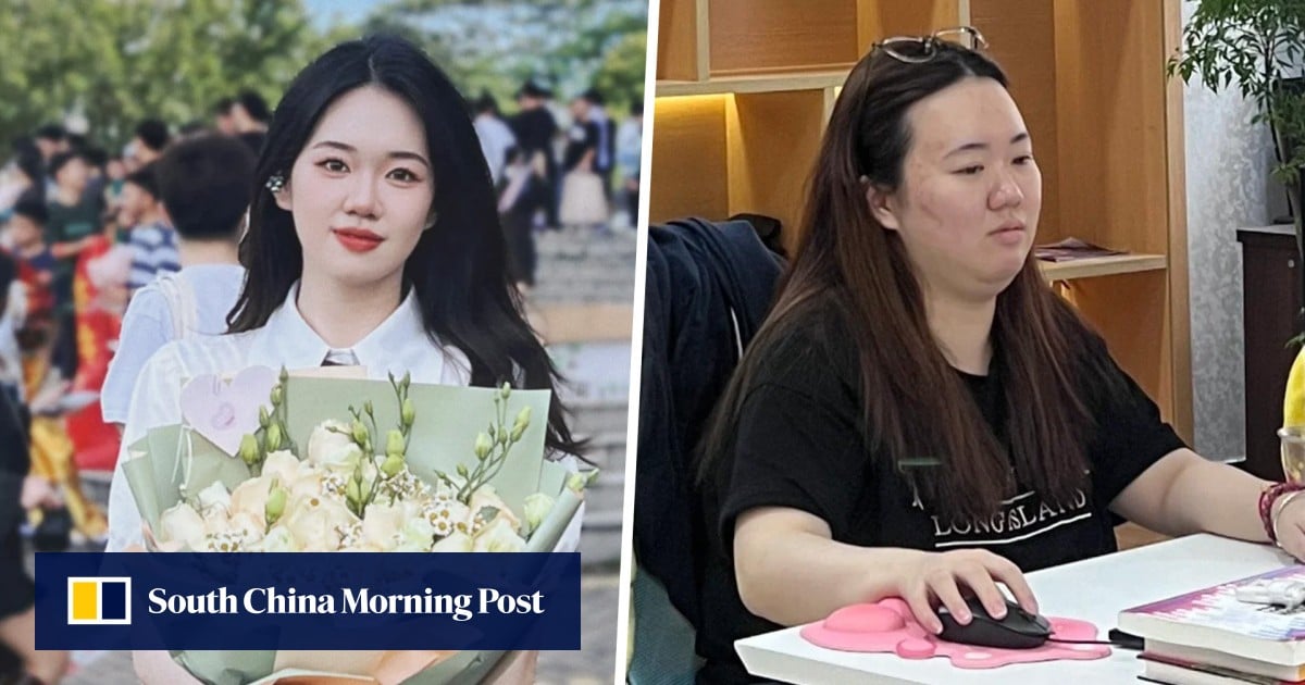 Woman gained 20kg in a year due to work stress, sees change after quitting