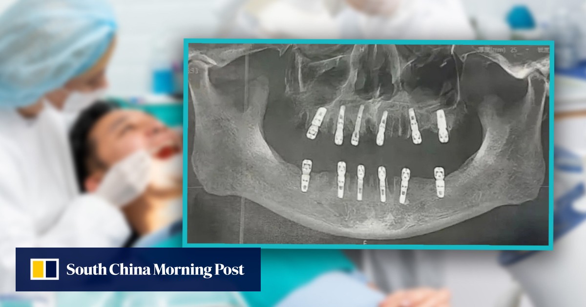 Chinese Man Dies Post Extensive Dental Procedure