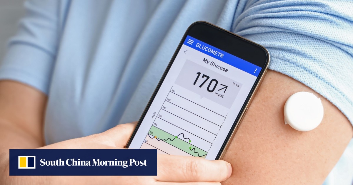 A close-up of a wearable glucose monitoring device being checked visually for health metrics.