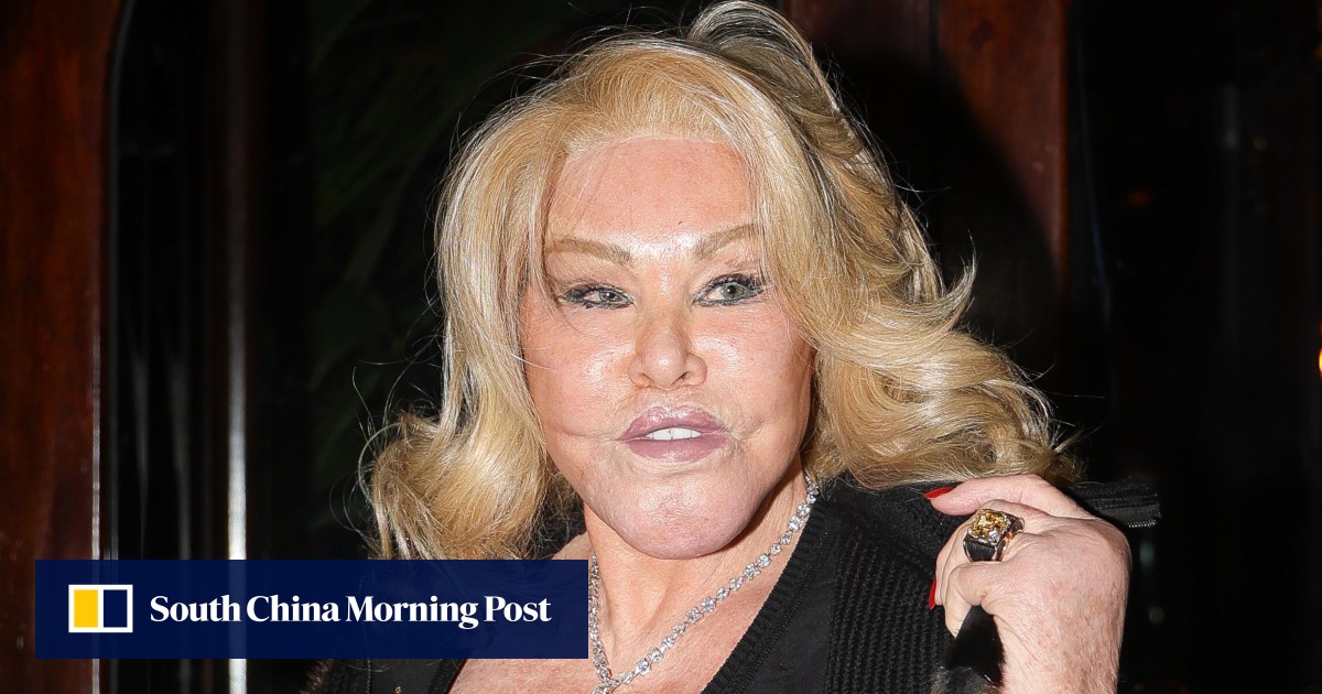 Catwoman Jocelyne Wildenstein known for her extensive plastic surgeries dead at 79  South China Morning Post